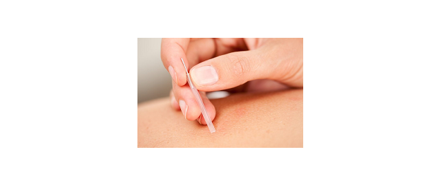 Acupuntura y Punción Seca