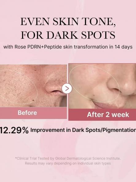 MEDICUBE PDRN Tónico Calmante Pink Cica 250 ml [2]