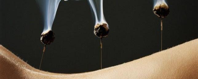 Moxas / Chinchetas / Semillas.