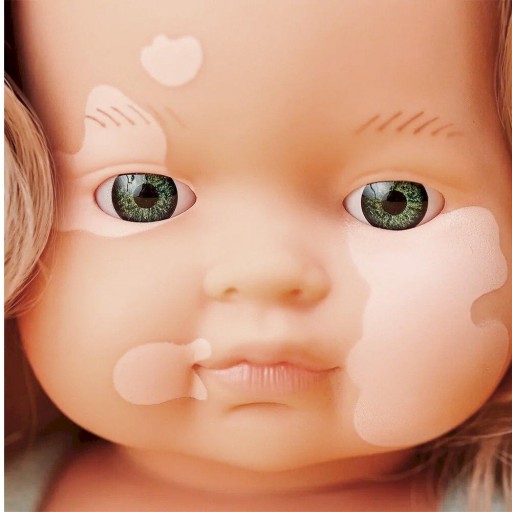 Muñeca Caucásica Vitíligo My Friends & Me 38 cm Miniland [2]