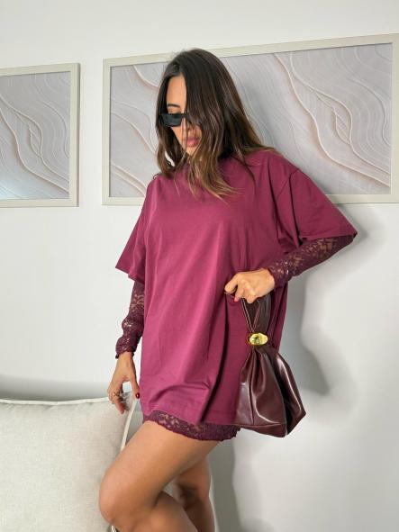 Vestido Urby |Oversize con mangas de encaje [5]