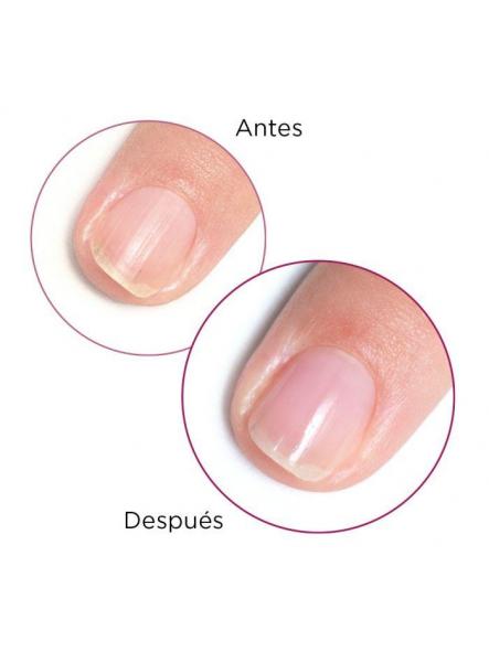 7 en UNO Tratamiento para uñas [1]