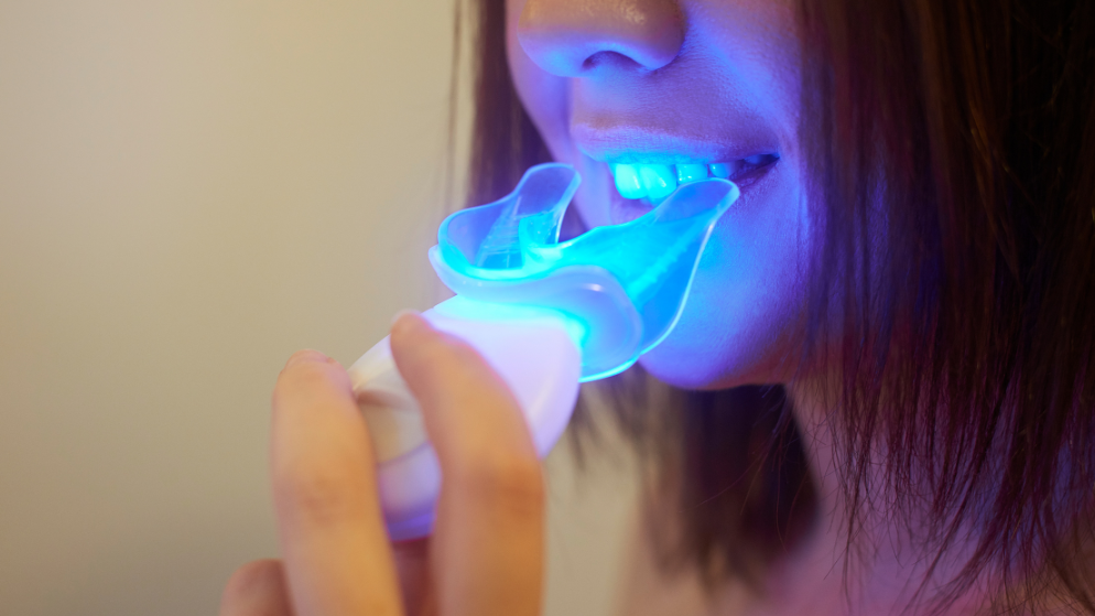 Los peligros del blanqueamiento dental casero y los productos no regulados.