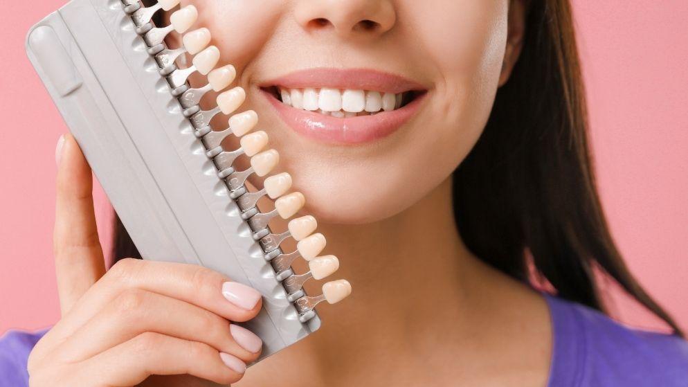 Tratamientos para modificar el tamaño y el color de los dientes