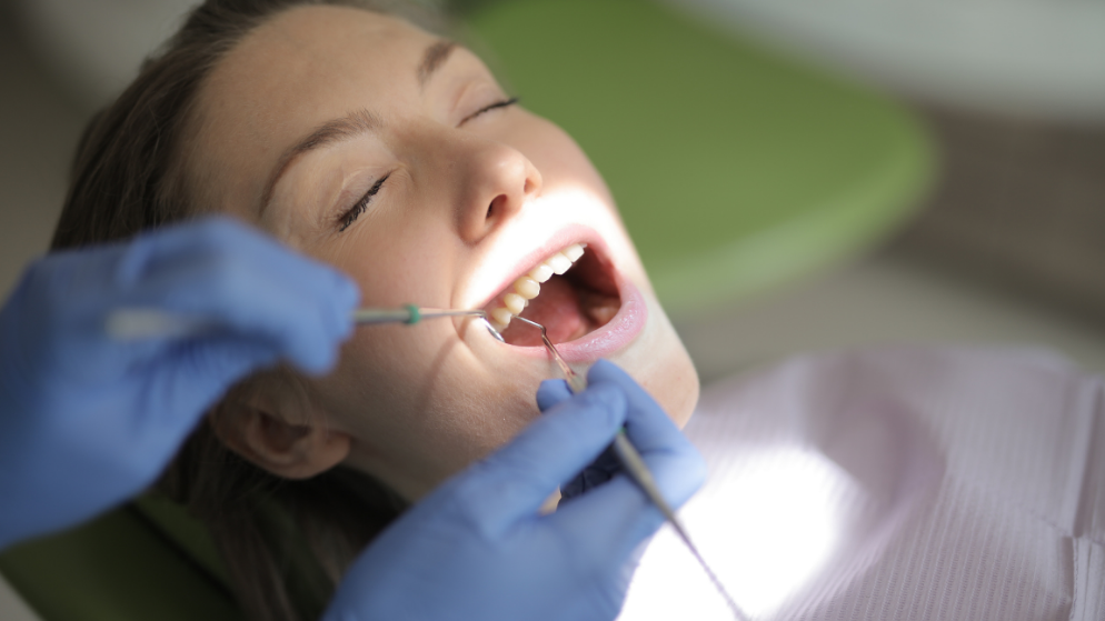 Diferencias entre raspado dental y limpieza profesional