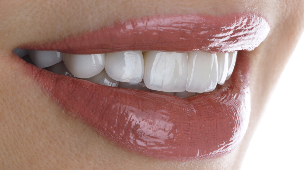 Tratamientos dentales para rejuvenecer tu sonrisa