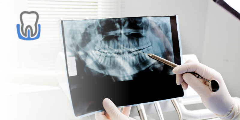 Regeneración ósea dental en Zaragoza