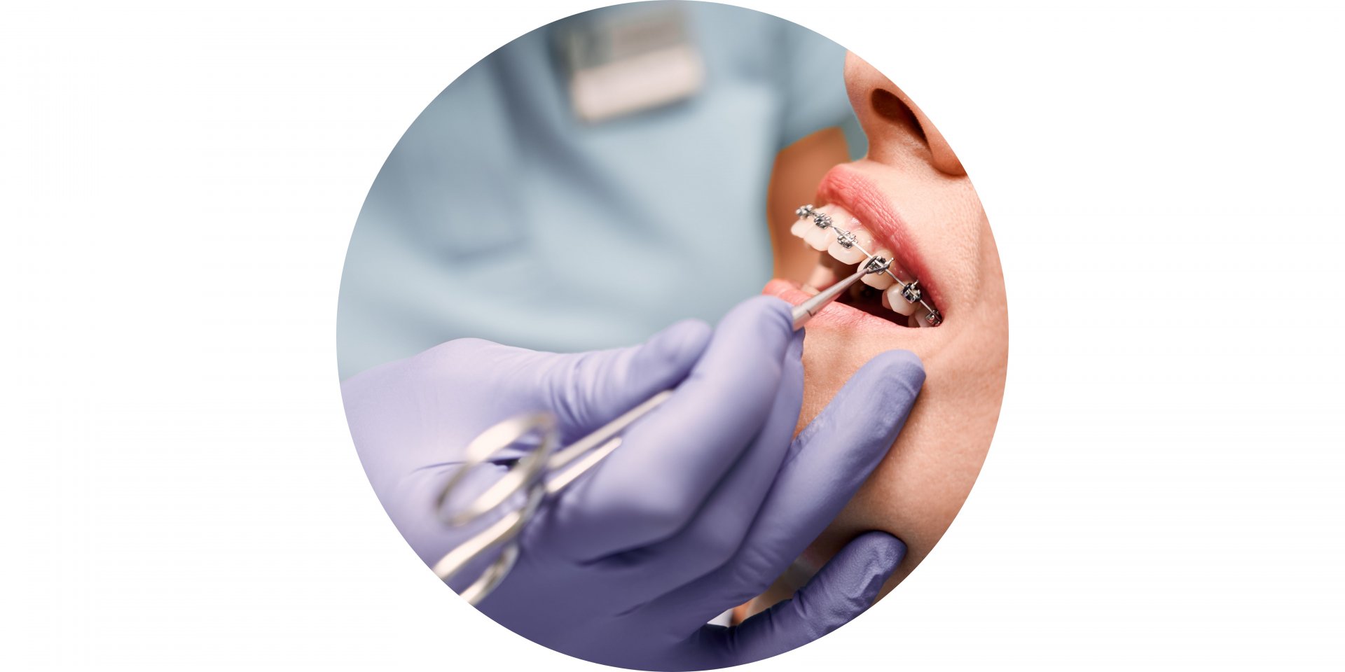 experiencia con ortodoncia de brackets