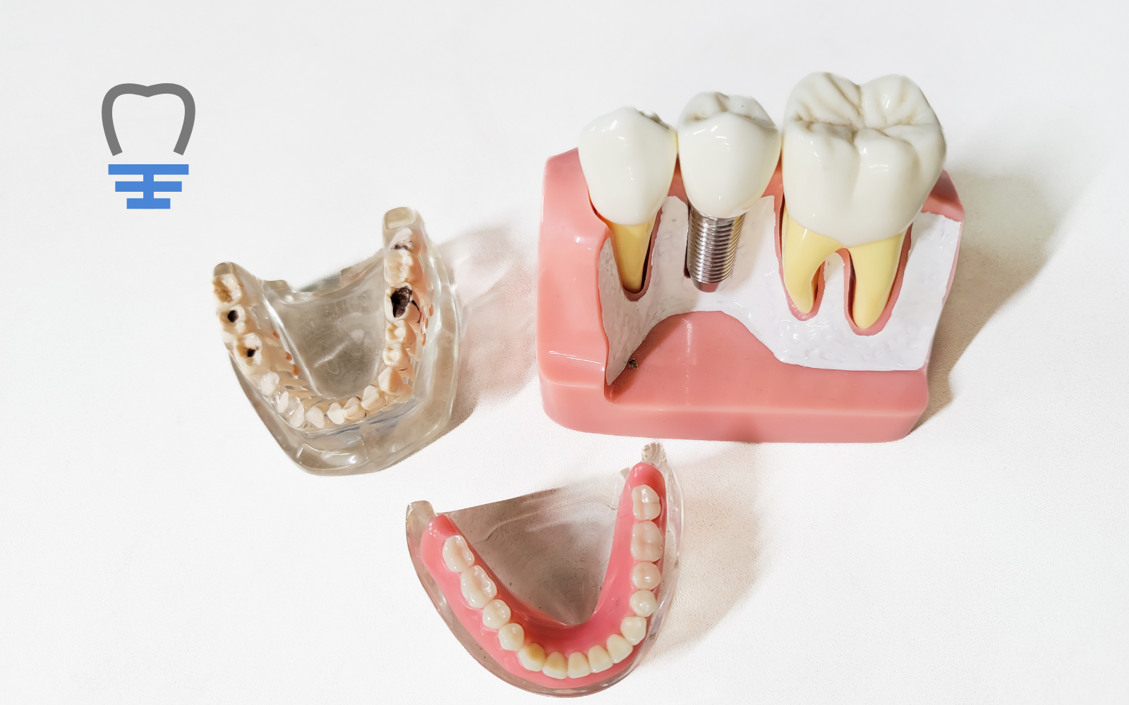 Implantologia en Zaragoza