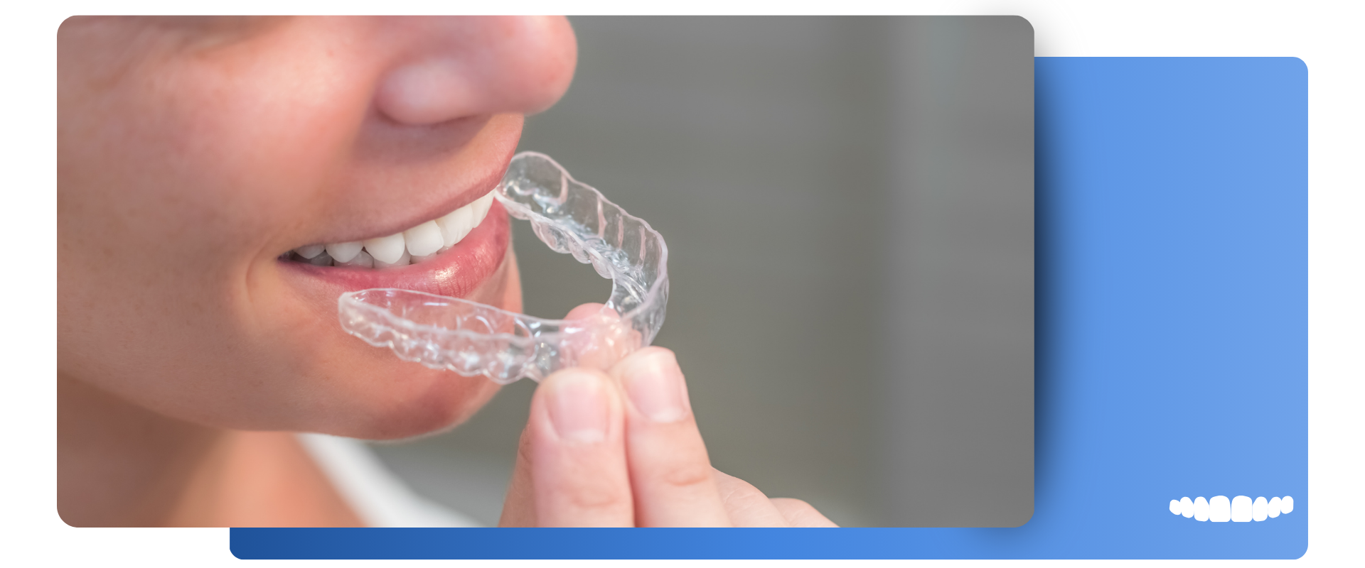 invisalign ortodoncia invisible