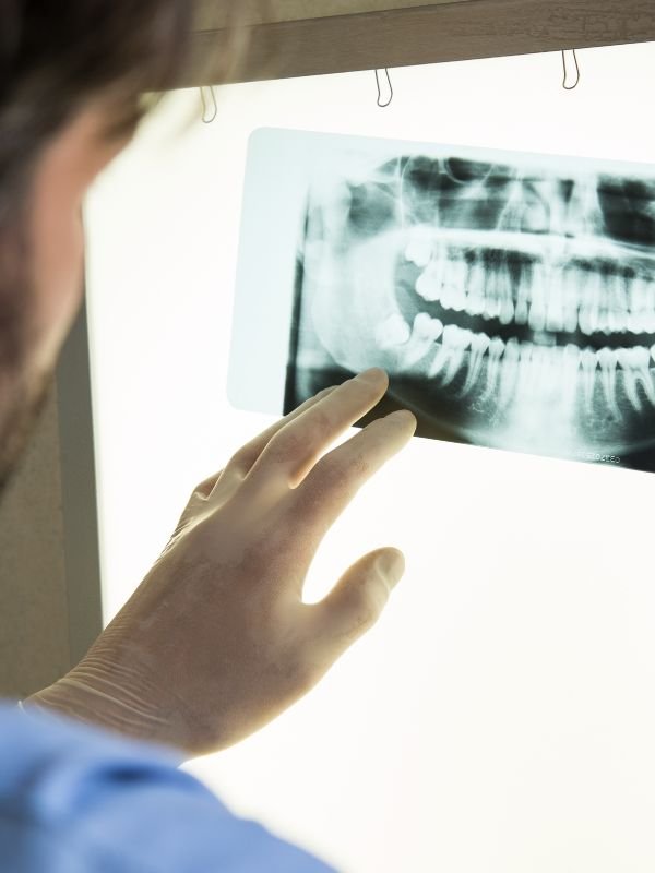 proceso de regeneración ósea dental en zaragoza