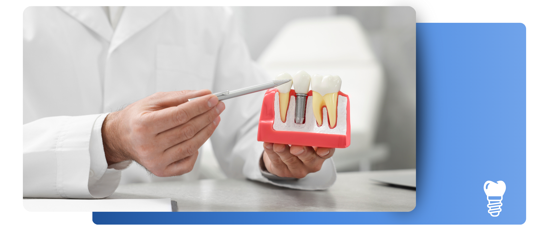 Proceso protesis dental