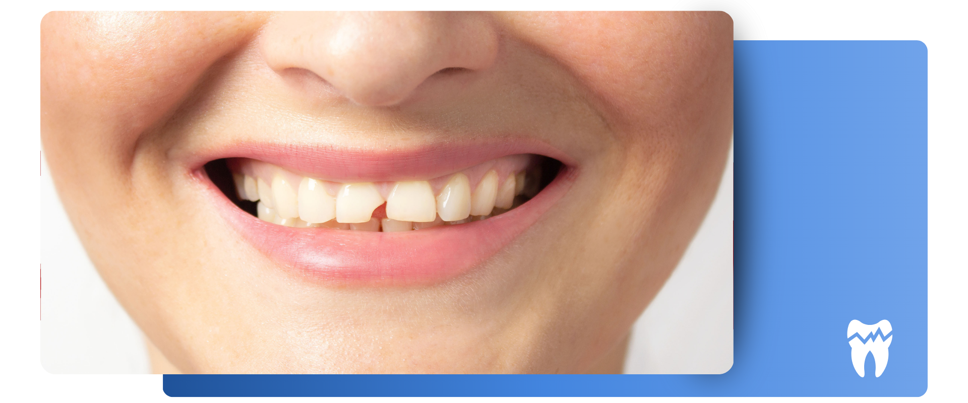 Prótesis mínimamente invasivas