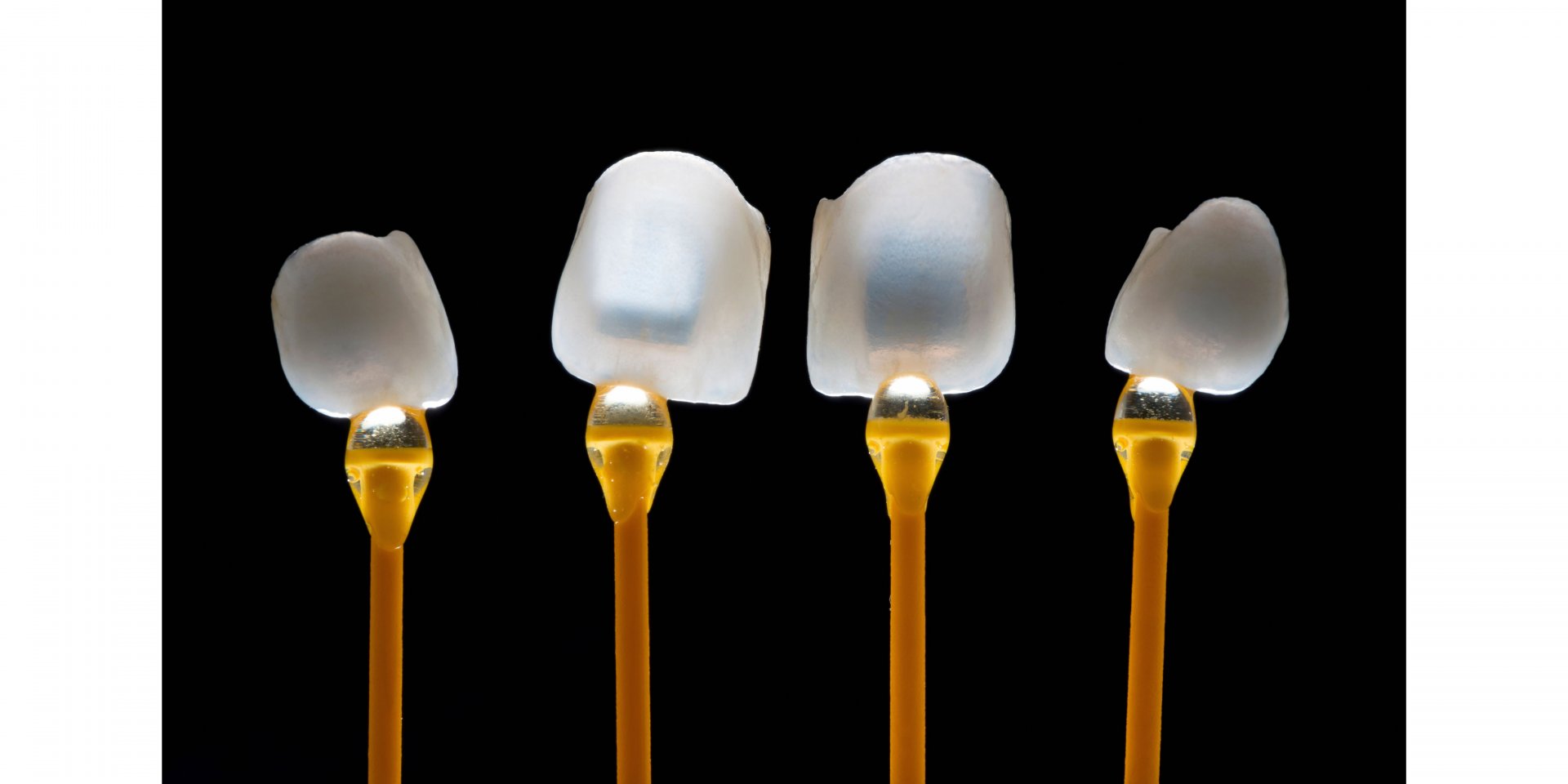 tipos de carillas dentales en clinica tello