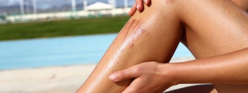 - Protectores de la piel